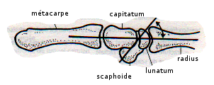 angle scapho-lunatum sur cliché latéral du poignet