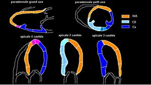 Echocardio segmentation.jpeg