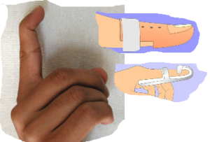 MalletFinger.png