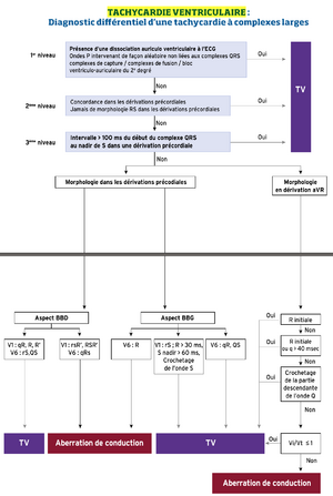 Tachycardie ventriculaire algorithme.png