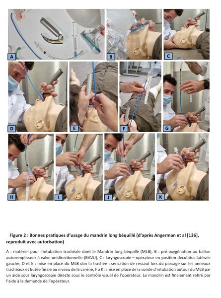 Fichier:Intubation frova.jpg