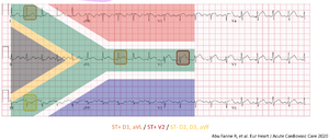 Sca sudafricain pattern.png