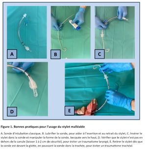 Intubation stylet souple.jpg