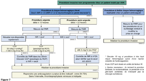 Anticoagulation sau avk chir.png