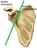 Fracture scapula.png