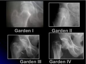 Garden radio.png